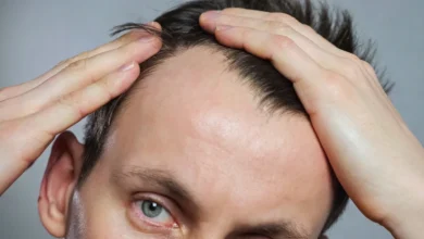 Could Doctors Predict Hair Loss Before Prescribing GLP