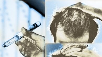 Could Your GLP-1 Be Making You Bald? One Study Says Maybe