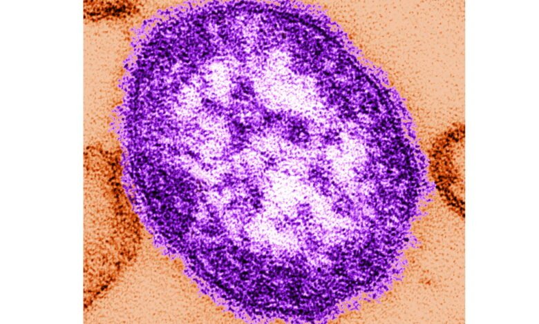 Pennsylvania says an unvaccinated girl has died from measles